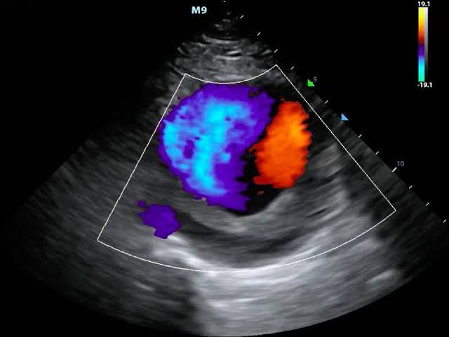 Color Doppler Service
